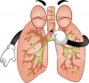 Làm sao để lao phổi không tái phát